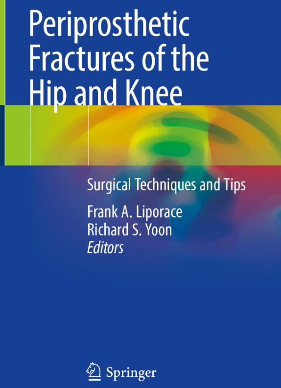 Periprosthetic Fractures of the Hip and Knee: Surgical Techniques and Tips