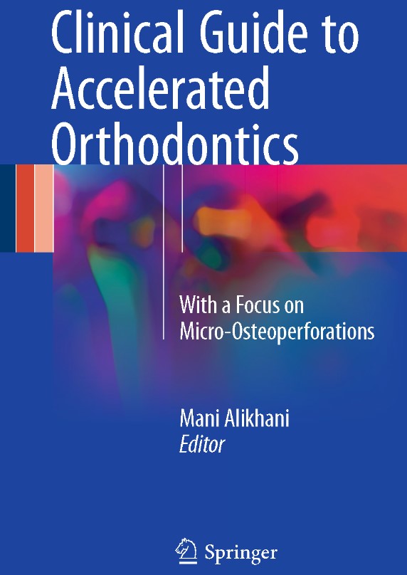 Clinical Guide to Accelerated Orthodontics