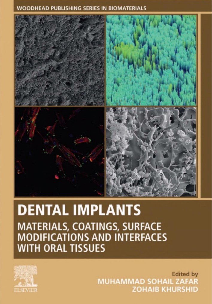 Dental Implants: Materials, Coatings, Surface Modifications and Interfaces with Oral Tissues