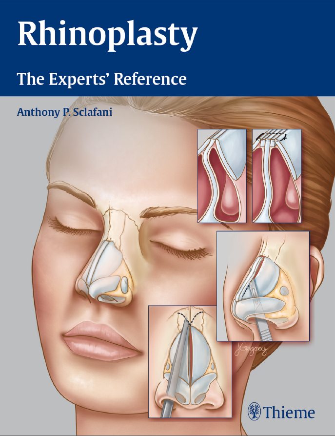 Rhinoplasty The Experts' Reference