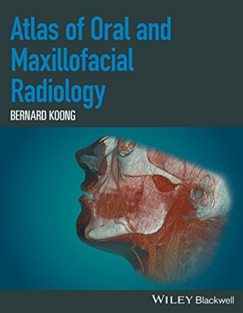 Atlas of Oral and Maxillofacial Radiology