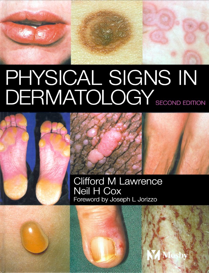 Physical Signs in Dermatology